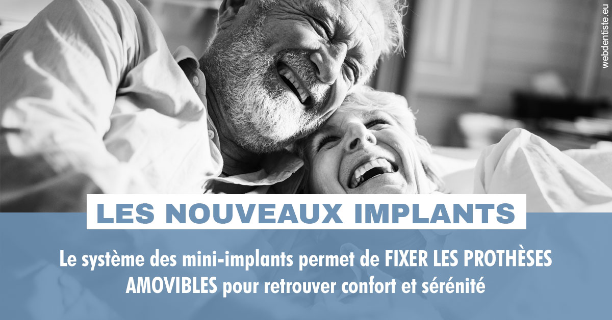 https://dr-remy-ouazana.chirurgiens-dentistes.fr/Les nouveaux implants 2