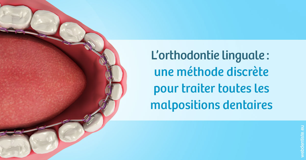 https://dr-remy-ouazana.chirurgiens-dentistes.fr/L'orthodontie linguale 1