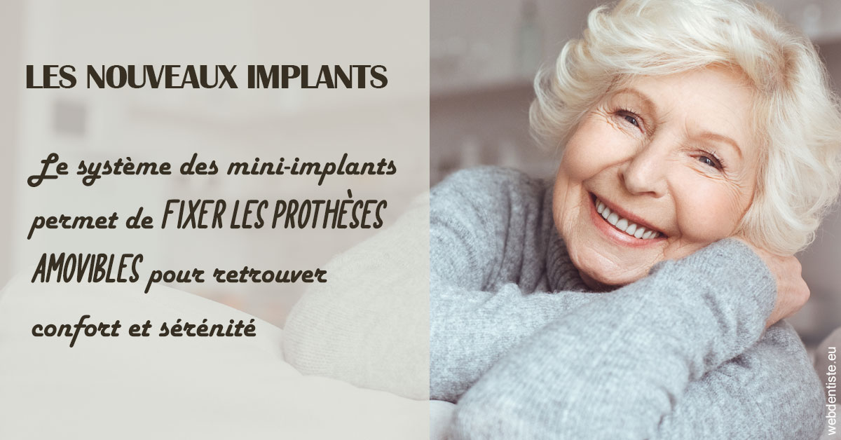 https://dr-remy-ouazana.chirurgiens-dentistes.fr/Les nouveaux implants 1
