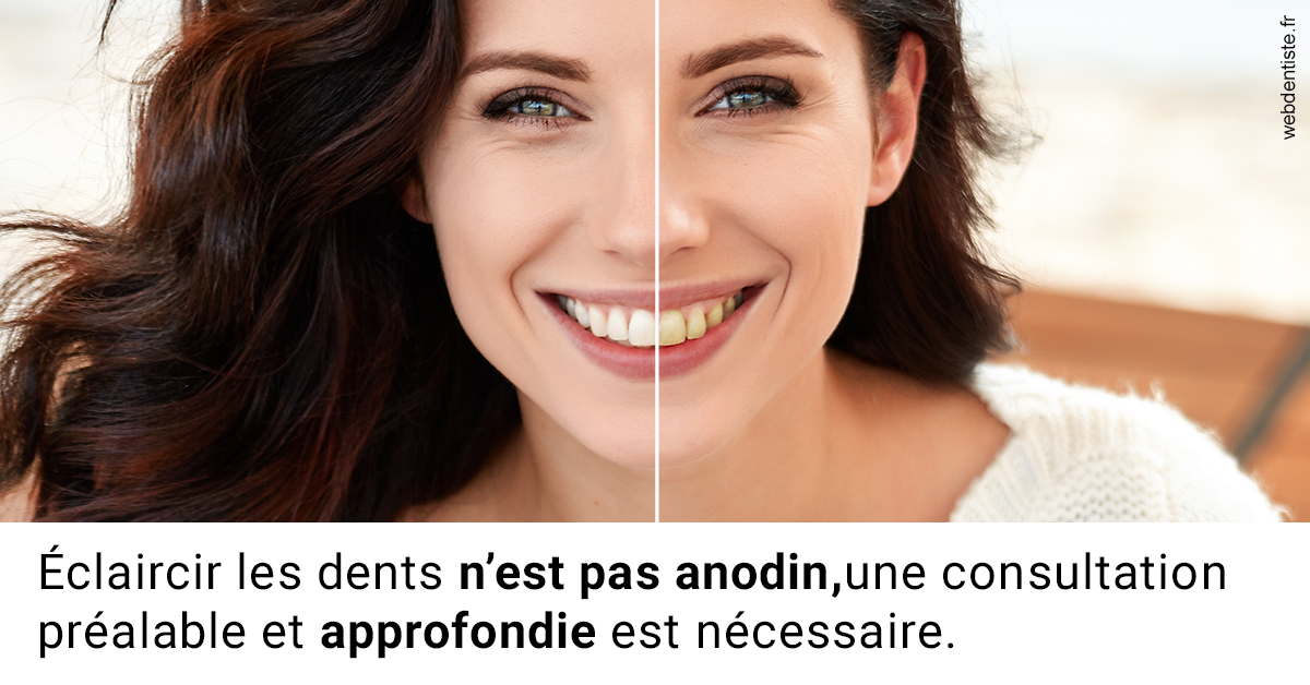 https://dr-remy-ouazana.chirurgiens-dentistes.fr/Le blanchiment 2