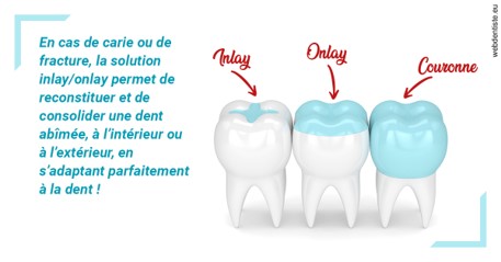 https://dr-remy-ouazana.chirurgiens-dentistes.fr/L'INLAY ou l'ONLAY