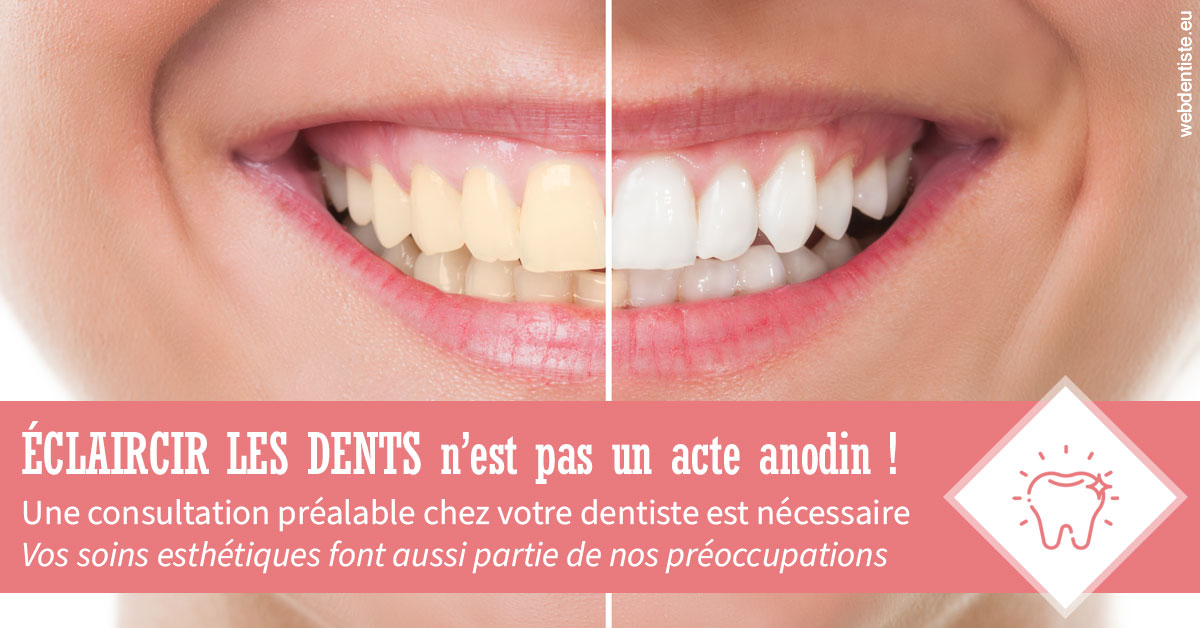 https://dr-remy-ouazana.chirurgiens-dentistes.fr/Eclaircir les dents 1