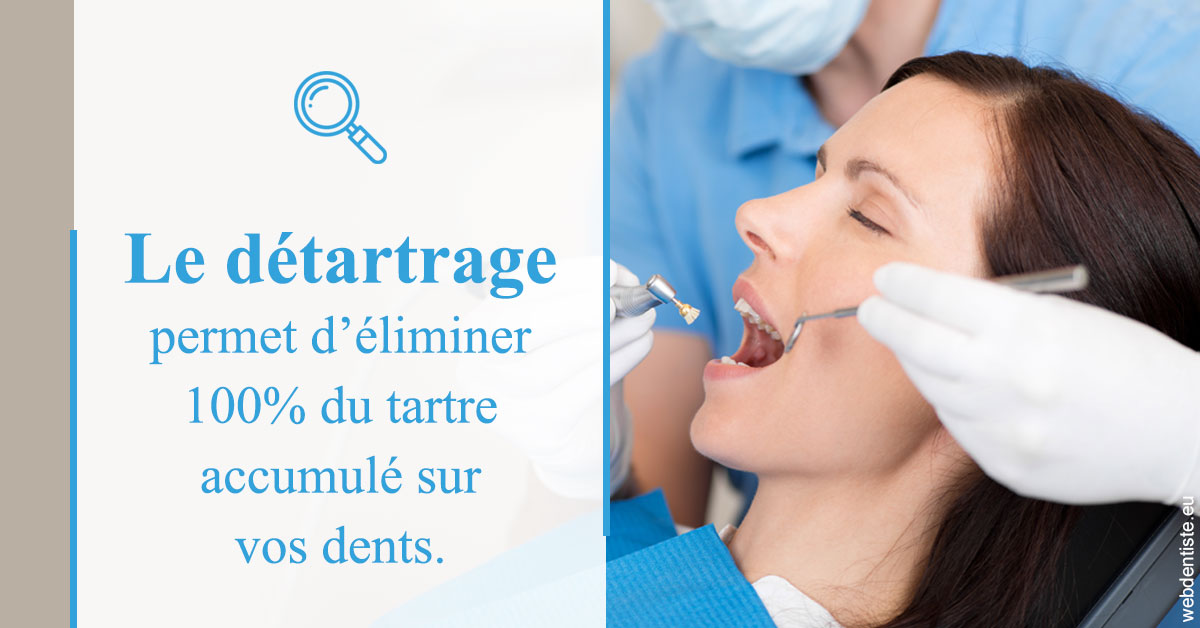 https://dr-remy-ouazana.chirurgiens-dentistes.fr/En quoi consiste le détartrage