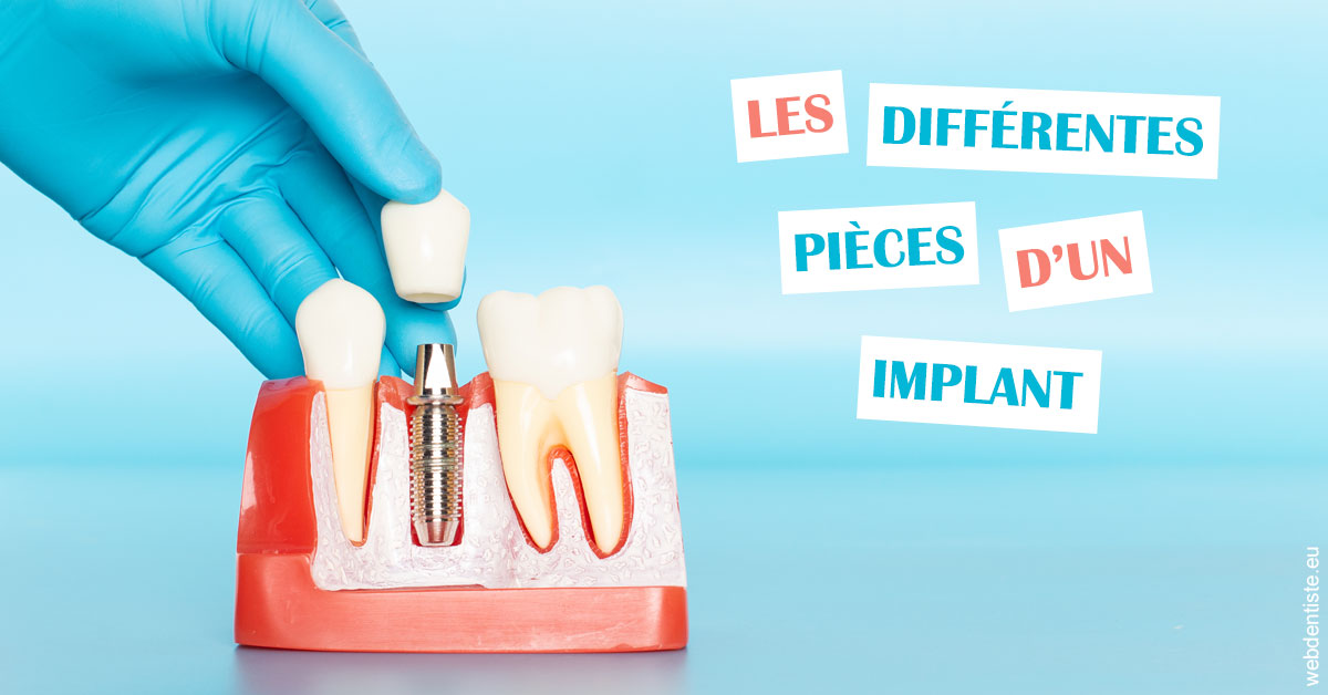 https://dr-remy-ouazana.chirurgiens-dentistes.fr/Les différentes pièces d’un implant 2