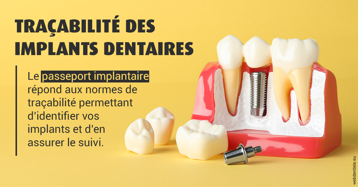https://dr-remy-ouazana.chirurgiens-dentistes.fr/T2 2023 - Traçabilité des implants 2