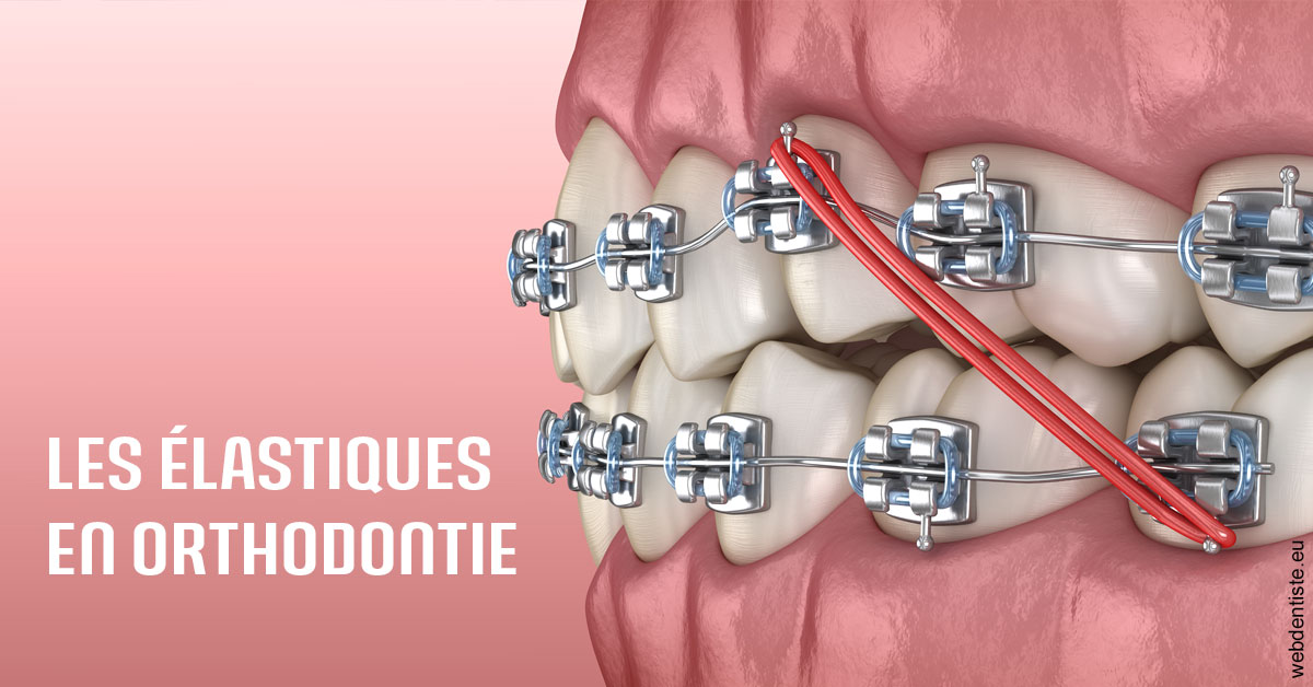 https://dr-remy-ouazana.chirurgiens-dentistes.fr/Elastiques orthodontie 2