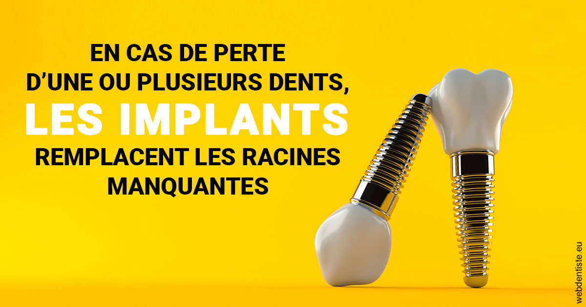 https://dr-remy-ouazana.chirurgiens-dentistes.fr/Les implants 2